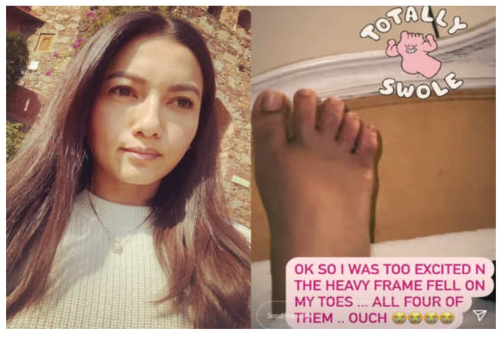 Gauahar Khan hurt after heavy photo frame falls on her feet