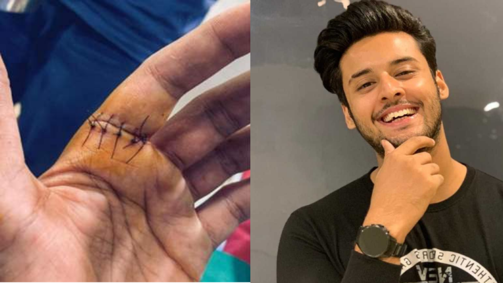 Meet fame Shagun Pandey gets six stitches on his hand