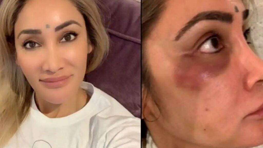 Sofia Hayat admitted to a hospital after her body salts fall dangerously low due to fasting