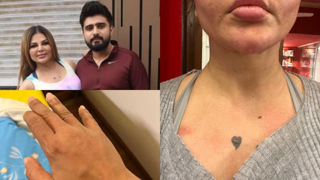 Rakhi Sawant’s lawyer reveals that Rakhi has evidence of assaults on her by Adil Khan Durrani