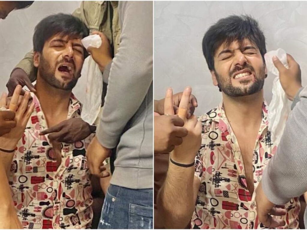 Kundali Bhagya fame Sanjay Gagnani gets badly injured while shooting