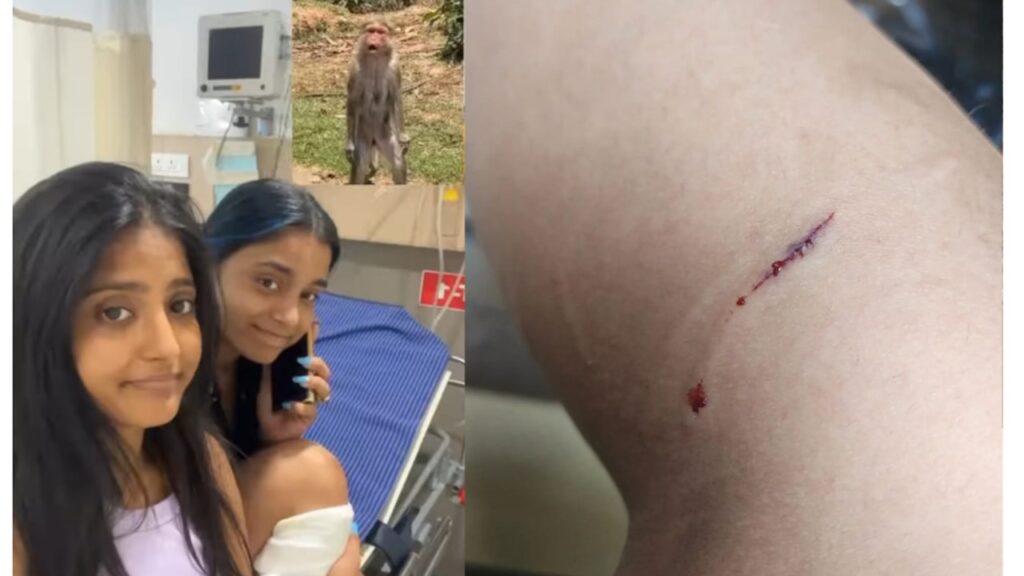Sumbul Touqeer gets bitten by a monkey on his vacation in Ooty