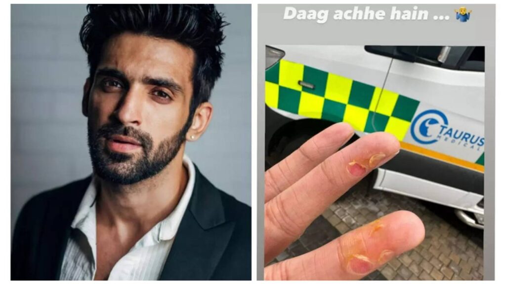 Arjit Taneja hurts his fingers while shooting for Khatron Ke Khiladi 13