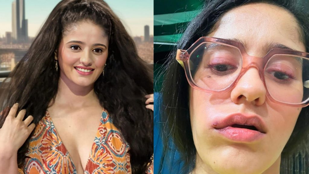 Ghum Hai Kisikey Pyaar Meiin Star Grapples with Unexplained Face Swelling