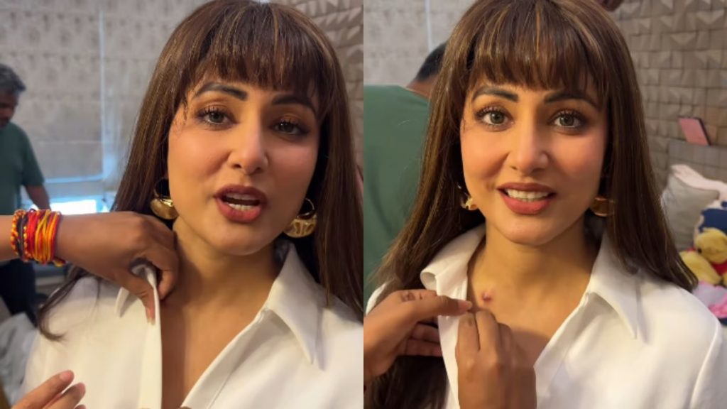 Hina Khan wears a wig, hides scars and Inspires with Her First Work Assignment After Chemotherapy